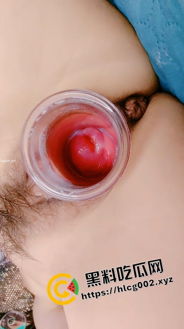 全面开发 重口慎入 小姐姐三十厘米假屌后入 扩阴道展示 子宫宫颈都能看见 这下真的长见识了-7