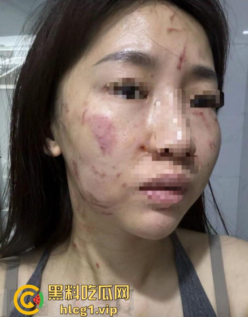 揭东区庵后村家暴男【高浩南】 不仅喜欢出轨还不怕报警 专吃硬的不愧是浩南哥!-8