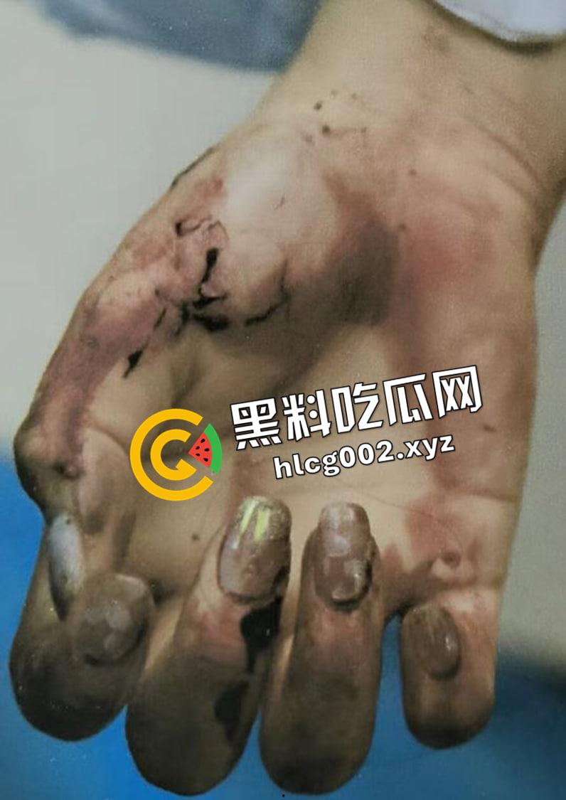 恐怖慎入！辽宁【徐园】案尸检现场视频流出 被前男友家暴致死打的面目全非-7