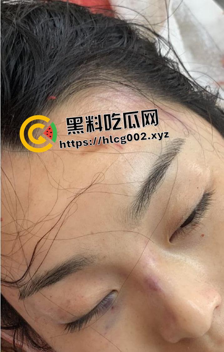 恐怖慎入！辽宁【徐园】案尸检现场视频流出 被前男友家暴致死打的面目全非-11