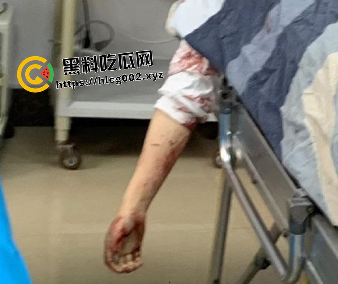 恐怖慎入！辽宁【徐园】案尸检现场视频流出 被前男友家暴致死打的面目全非-12