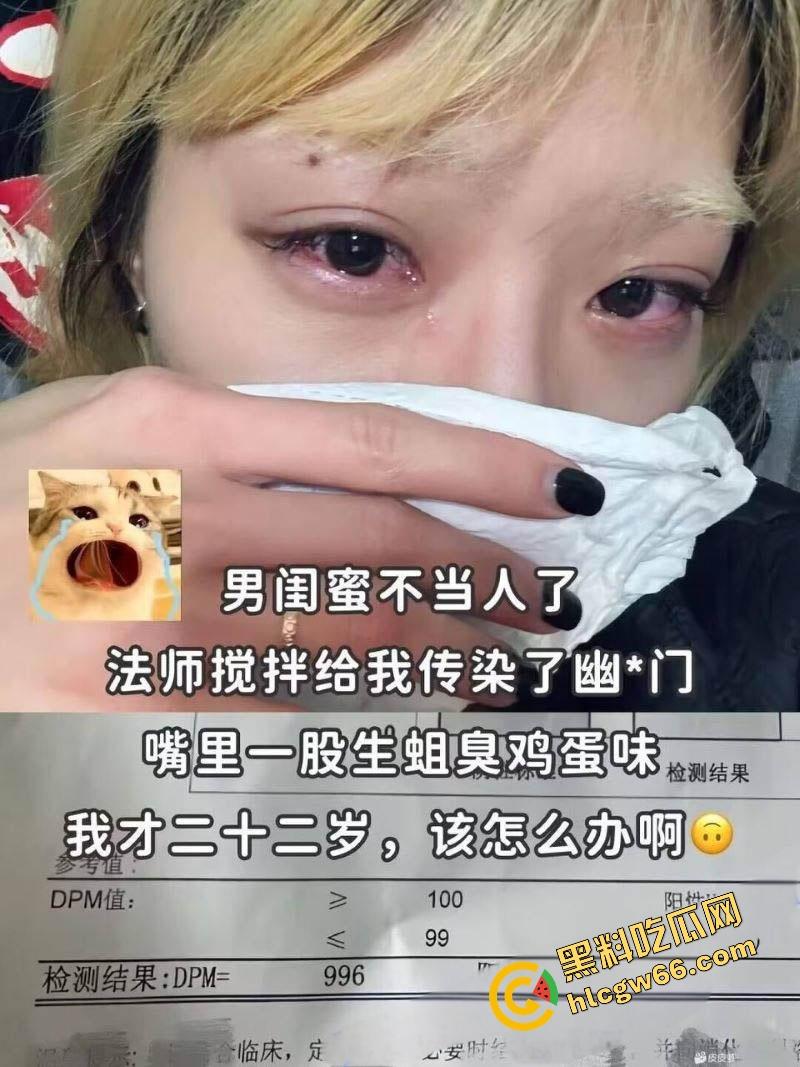 22岁美女被男闺蜜干爆肛后立马口交吃自己屎,惨遭幽门螺杆菌入侵,嘴里臭过粪坑,这操作太逆天!-1
