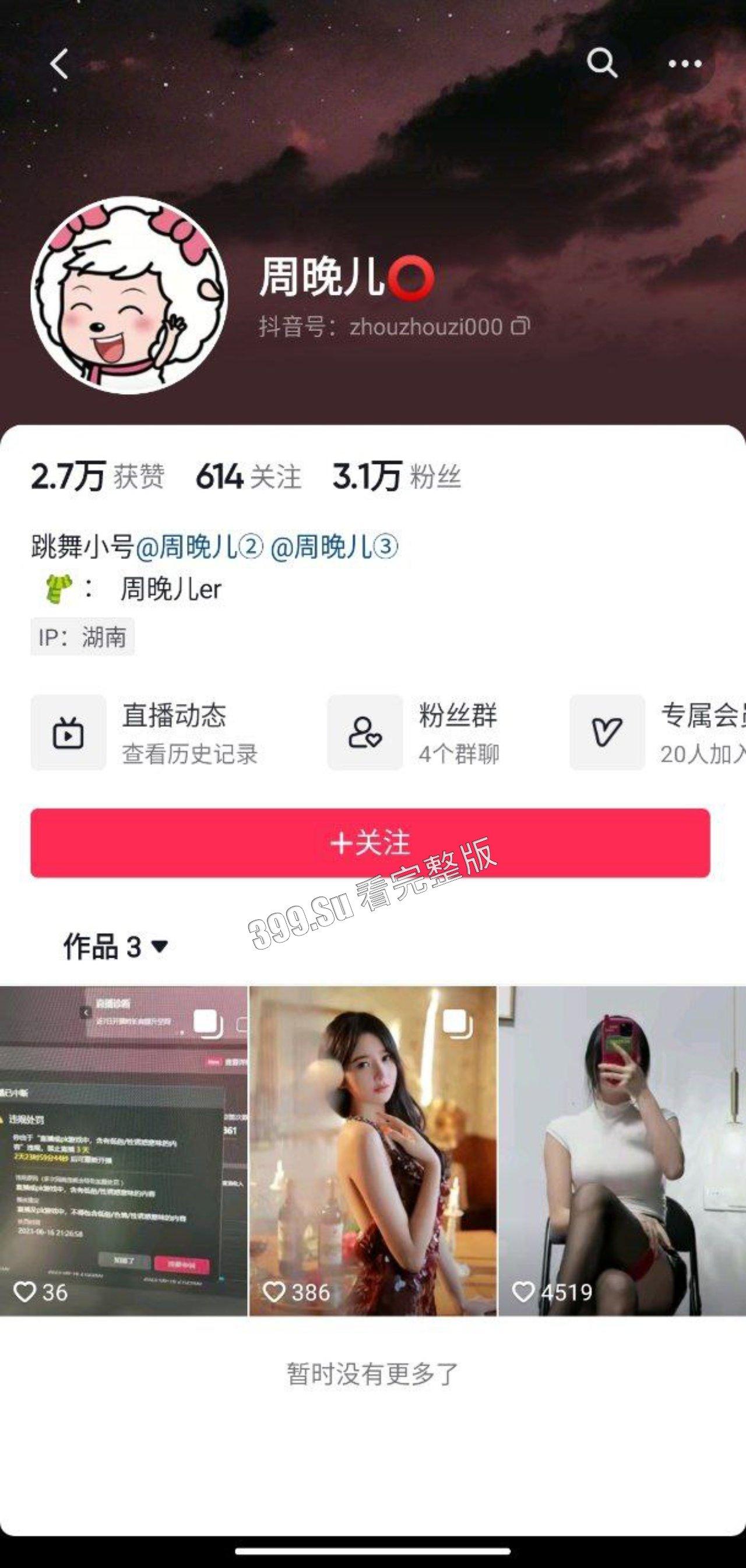 抖音 周晚儿 土豪的私拍露点福利+直播大尺度PK整活-1