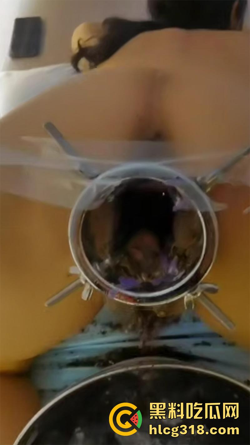 重口极限引导扩张虐穴,逼里塞图钉钢管插子宫口,鸡巴爆插尿道操的骚逼白浆四溢,宫颈真像个鱼唇!-6