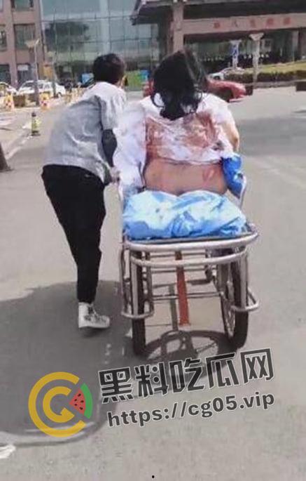 坦克坠楼!三百斤猪猪女孩12楼跳下 车都砸坏了人没死 事后检查仅骨折-6