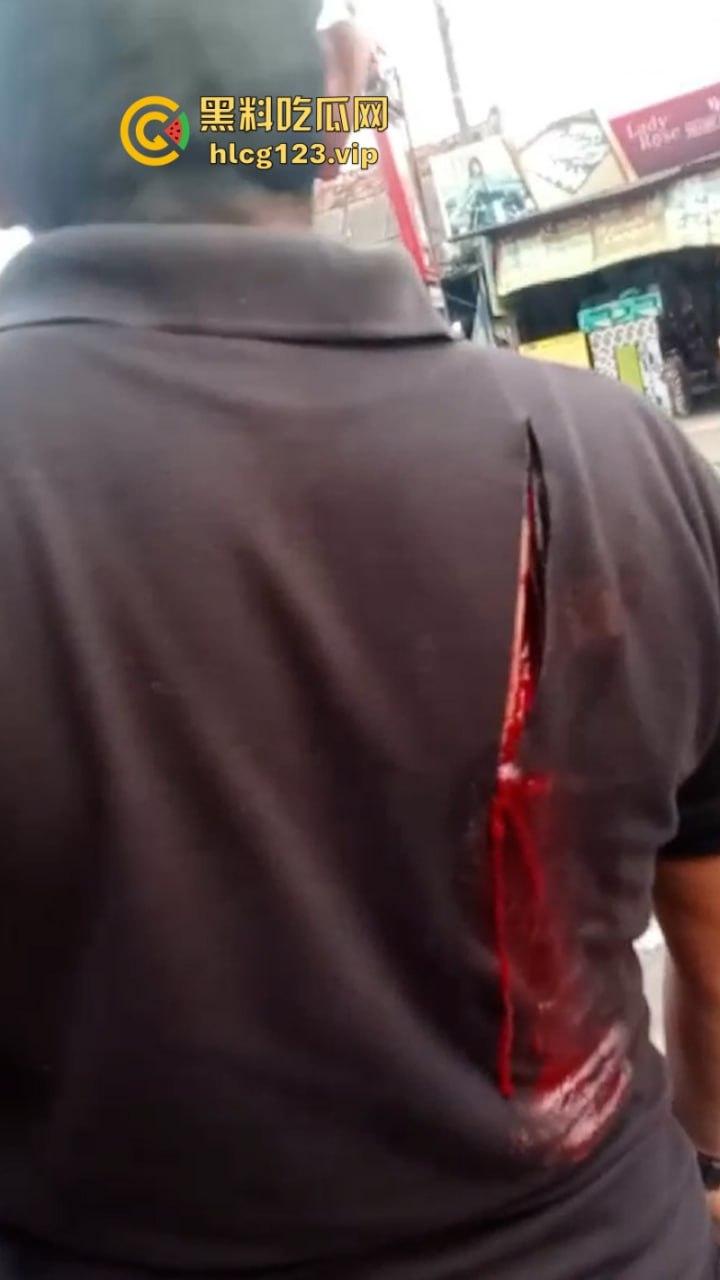 大型皮开肉绽现场!印尼一地发生冲突 有内战的国家真的不要去!-7