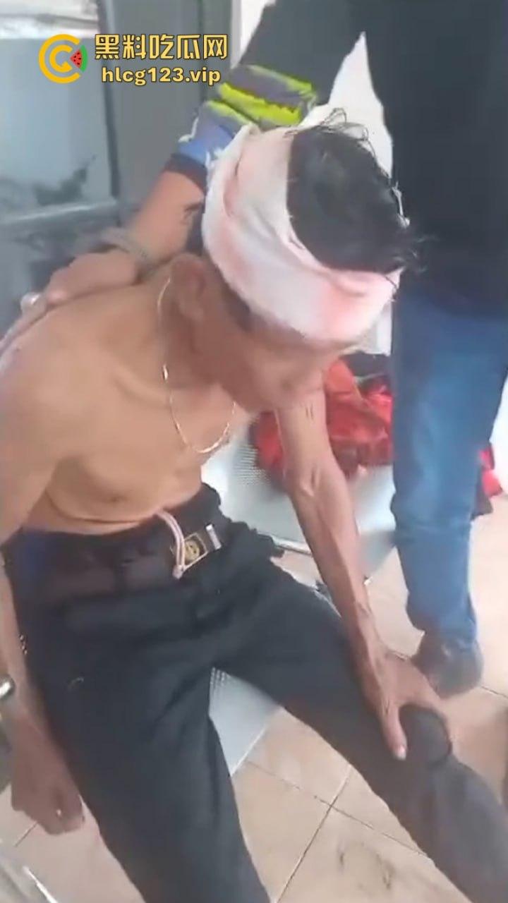 大型皮开肉绽现场!印尼一地发生冲突 有内战的国家真的不要去!-9