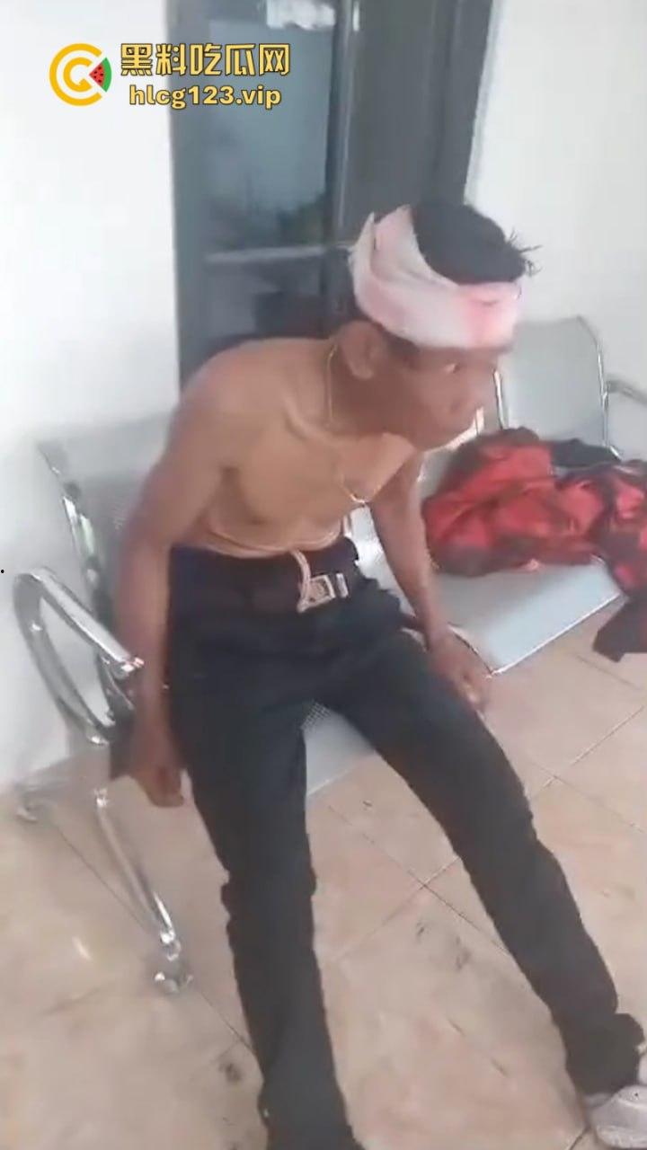 大型皮开肉绽现场!印尼一地发生冲突 有内战的国家真的不要去!-10